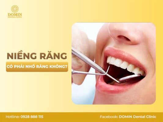 Niềng răng có phải nhổ răng