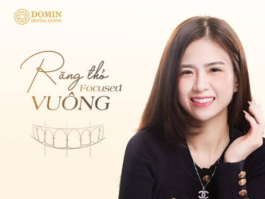 Dáng răng thỏ vuông