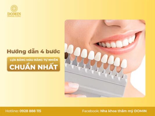 Hướng dẫn 4 bước lựa bảng màu răng tự nhiên phù hợp với bạn