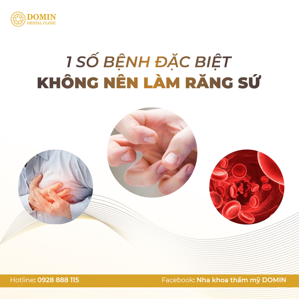 Một số bệnh lý sức khỏe không nên làm răng sứ