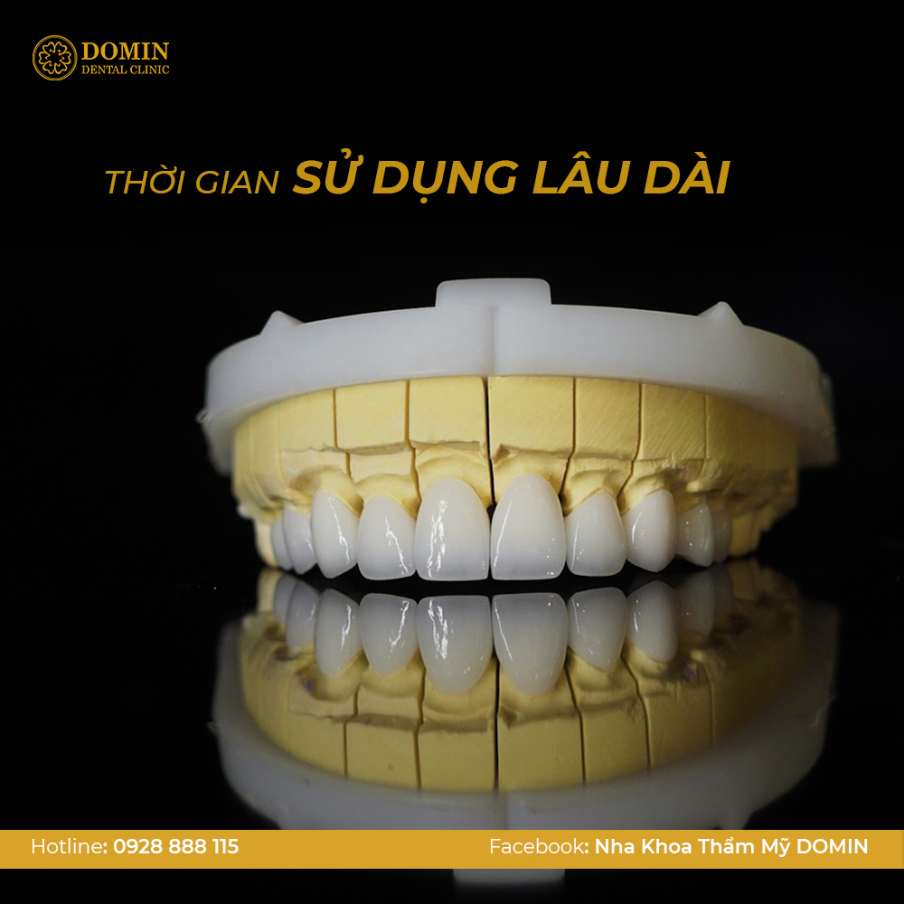 Răng sứ có thời gian sử dụng lâu dài hơn trám răng