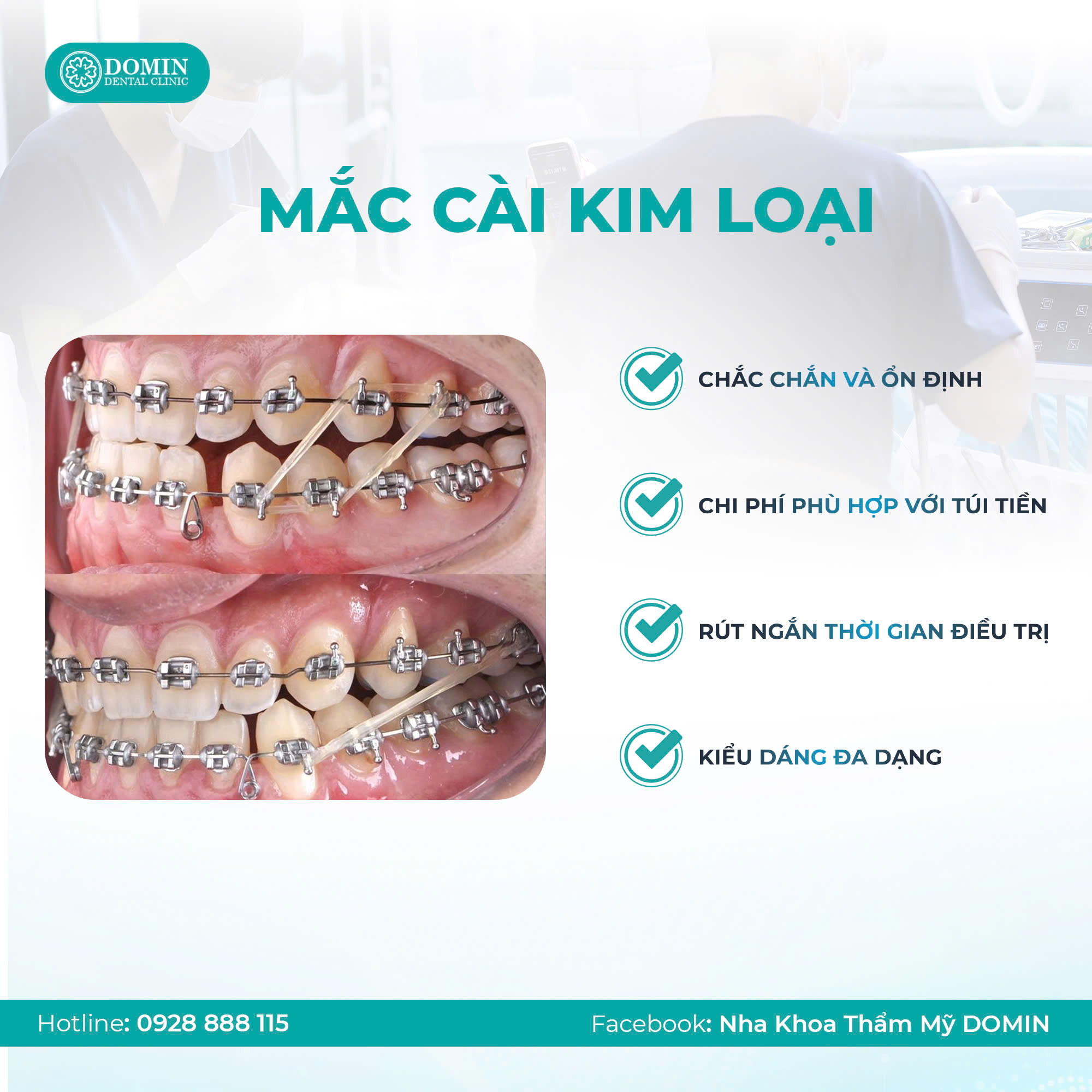 Vì sao niềng răng mắc cài kim loại vẫn được ưa chuộng?