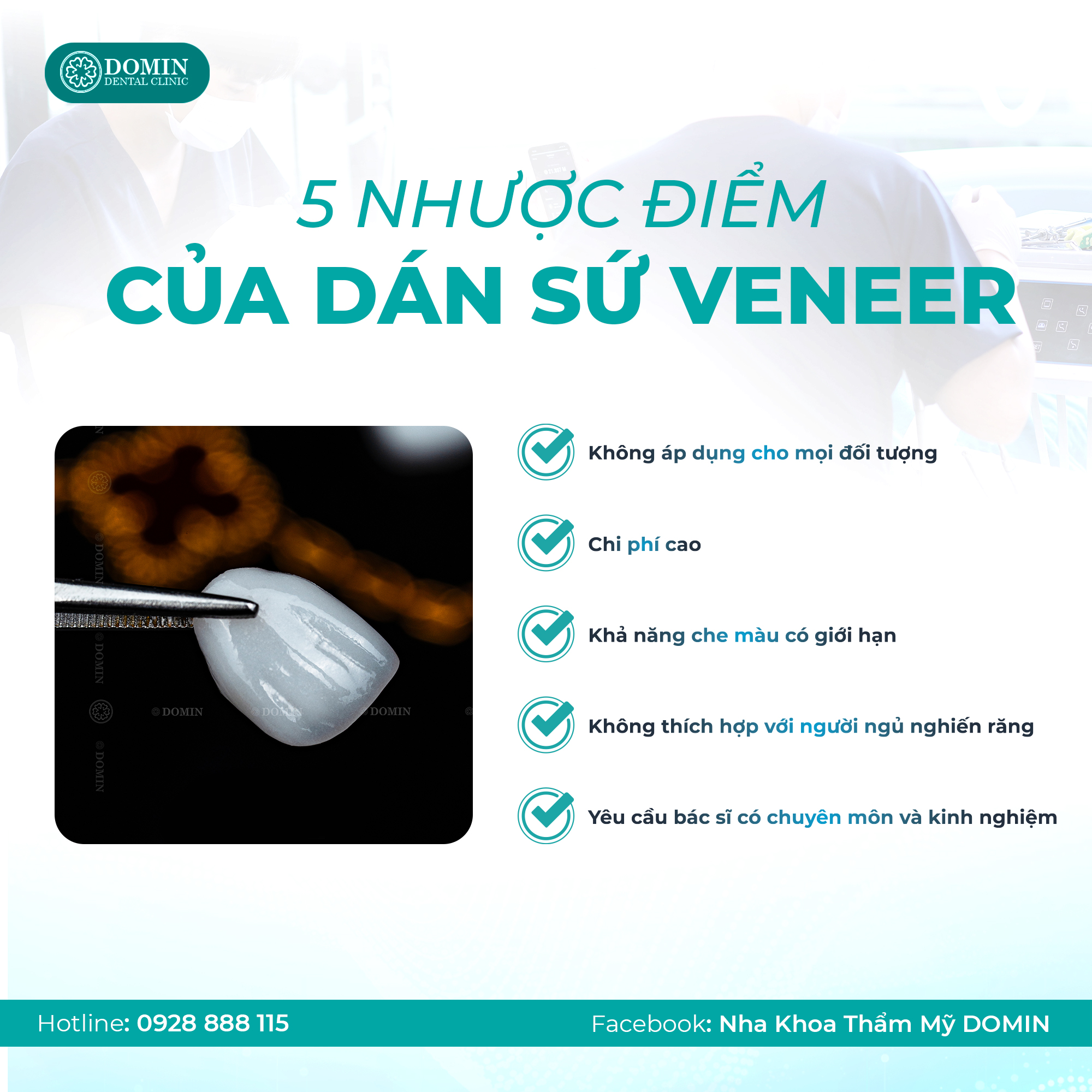 5 Nhược Điểm Của Dán Răng Sứ Là Gì?