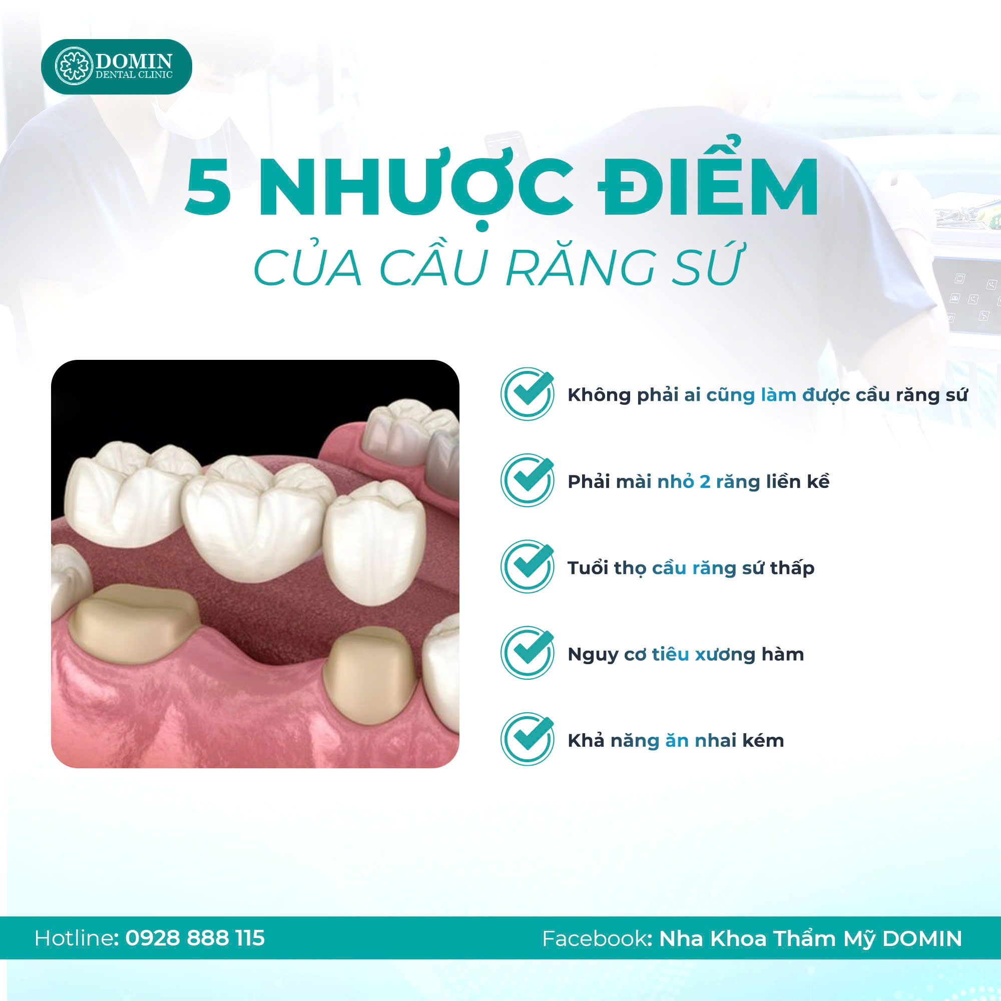 5 nhược điểm của cầu răng sứ bạn đã biết chưa?