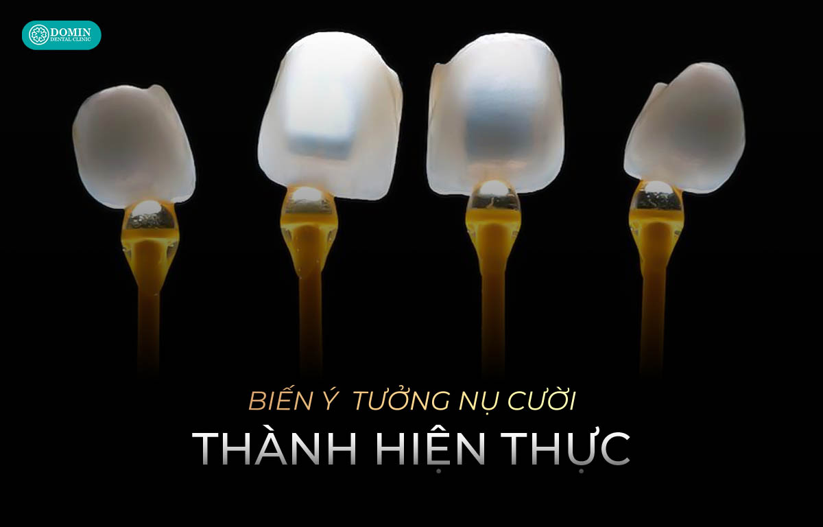 Độ mỏng hợp lý giúp mang lại hiệu quả thẩm mỹ tự nhiên.