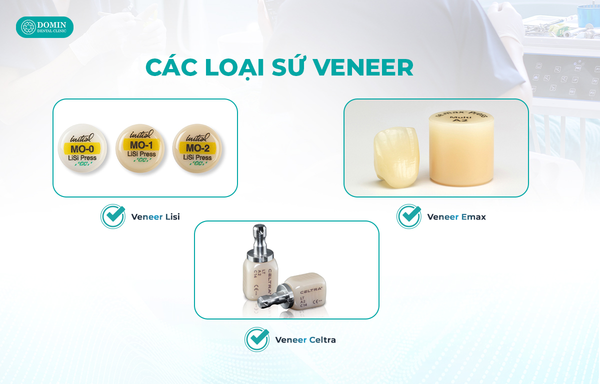 Các loại mặt dán sứ veneer dùng phổ biến