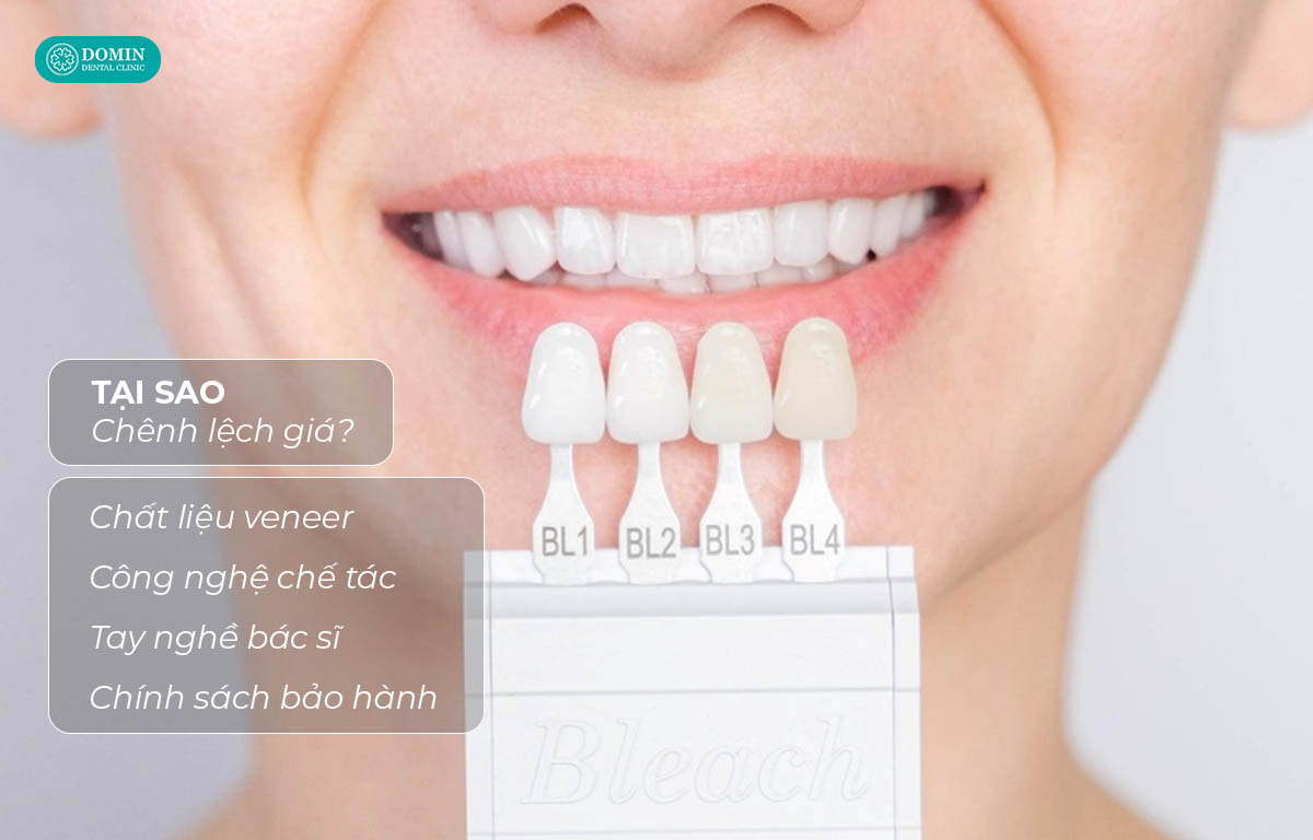 Có nhiều yếu tố quyết định đến giá dán sứ veneer 2 răng cửa bao nhiêu?