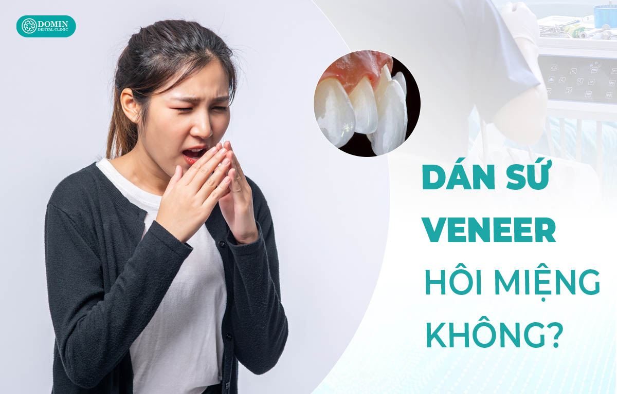 Dán sứ veneer có bị hôi miệng không.