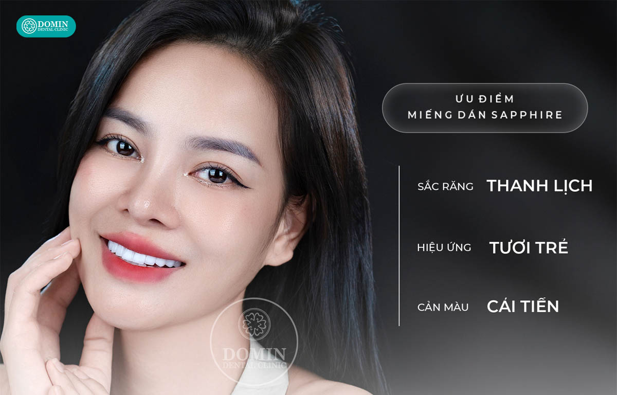 Veneer Sapphire nổi bật với khả năng chịu lực vượt trội.
