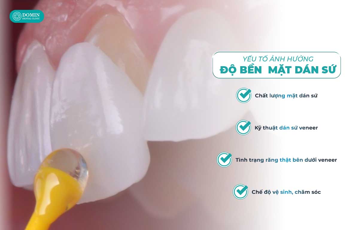 Yếu tố ảnh hưởng độ bền mặt dán sứ