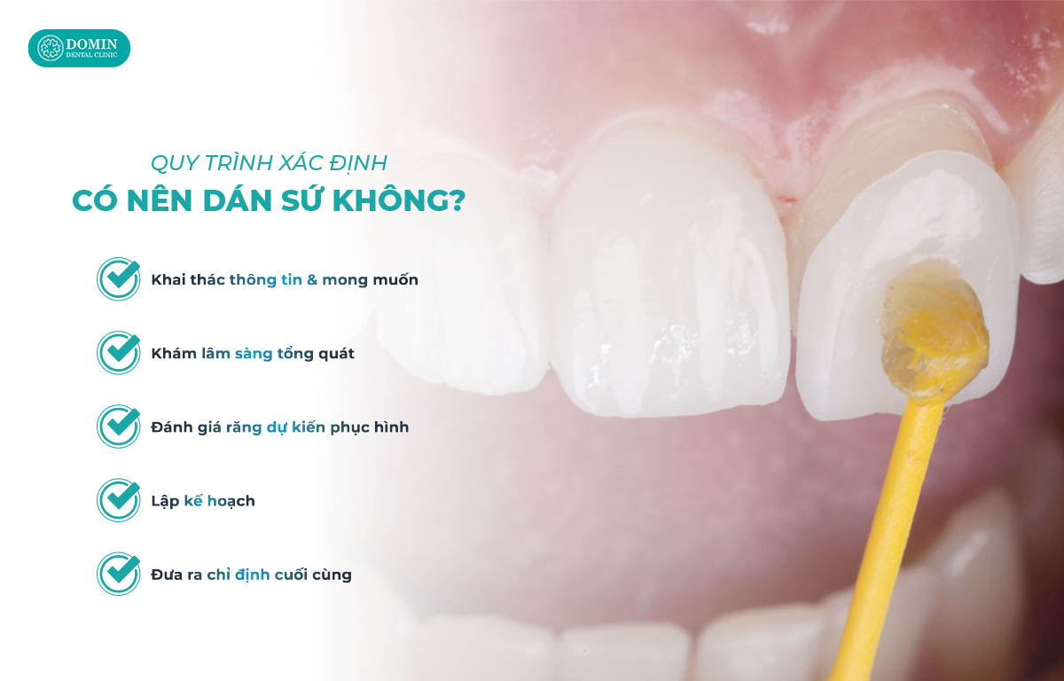 Cách giúp xác định có nên dán sứ hay không?