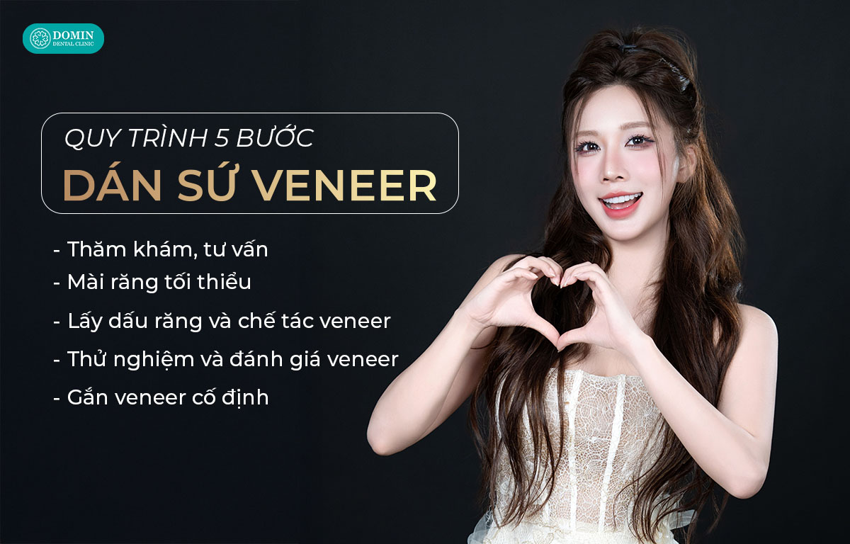 Quy trình dán sứ veneer gồm 5 bước