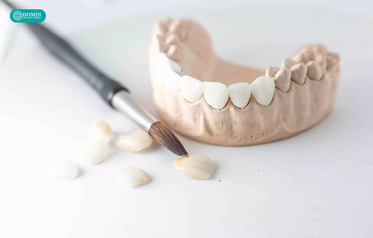 Vật liệu sứ kém chất lượng là nguyên nhân gây hôi miệng