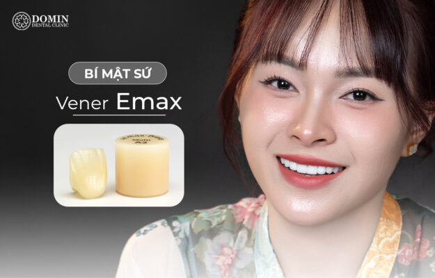 Dán sứ veneer emax