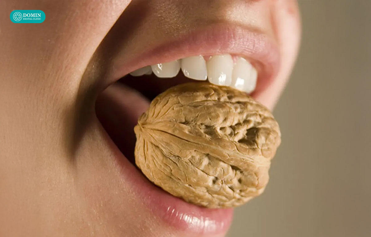 Tránh ăn đồ dai cứng sau dán sứ veneer