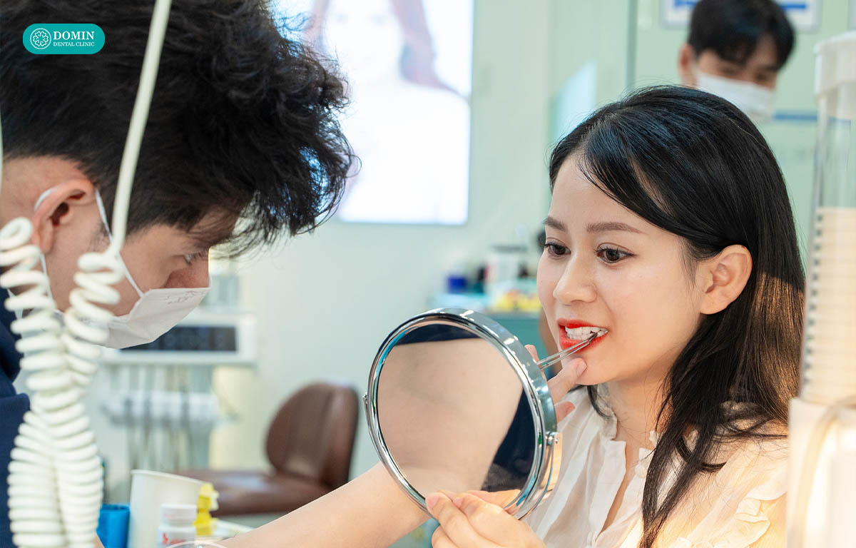 Cần thăm khám trực tiếp để có chỉ định có nên dán sứ veneer răng hàm không