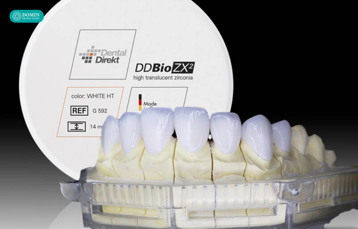 Dán sứ veneer Ddbio là một lựa chọn tốt nếu đúng chỉ định và đúng trường hợp.