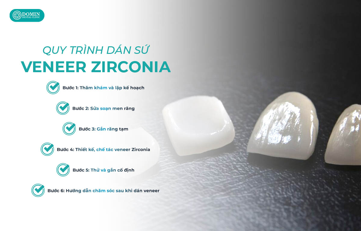 Quy trình dán sứ veneer Zirconia bao gồm 6 bước cơ bản.