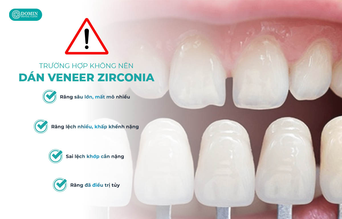 Các trường hợp không nên thực hiện dán veneer Zirconia