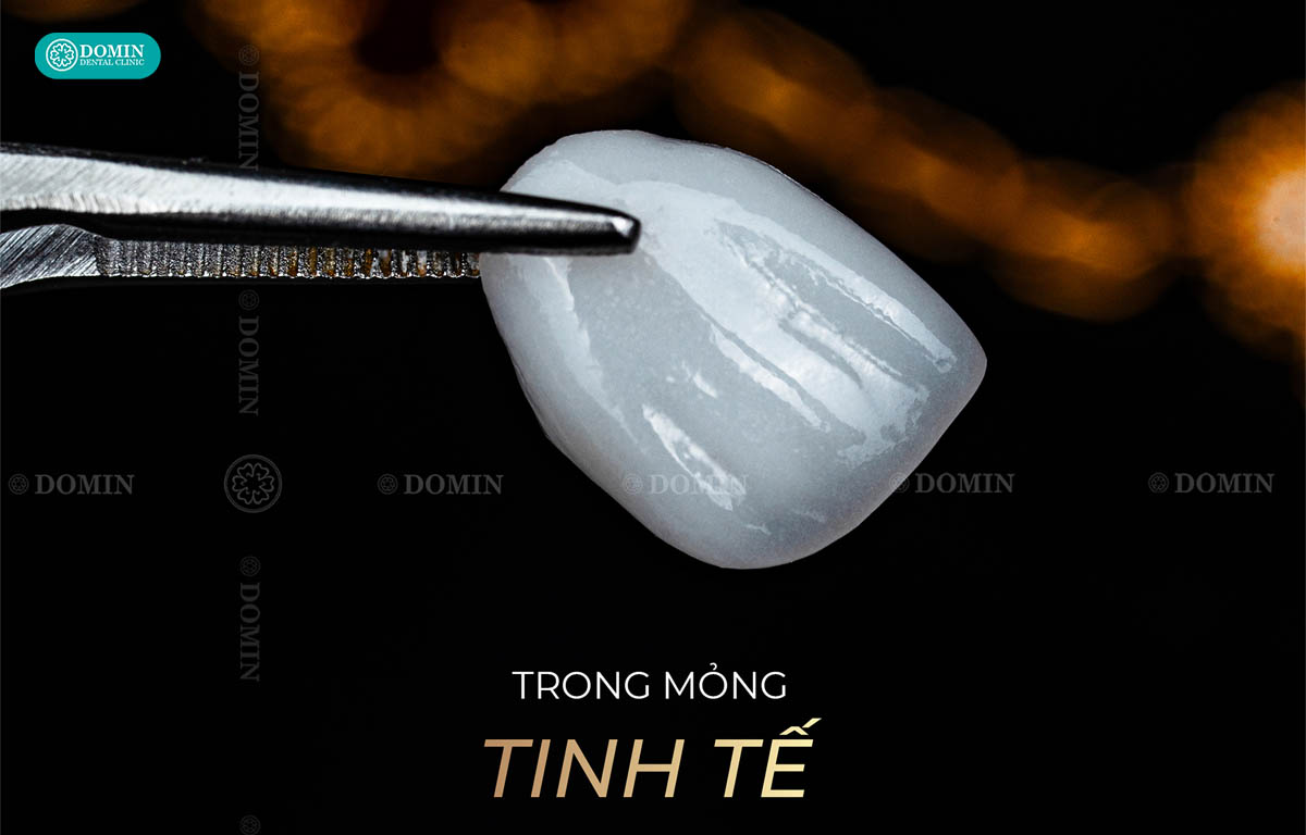 Veneer sứ thuỷ tinh trong, mỏng, đảm bảo thẩm mỹ tuyệt đối.