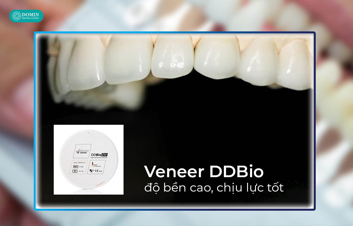 Dán sứ veneer Zirconia có độ bền cao và chịu lực tốt