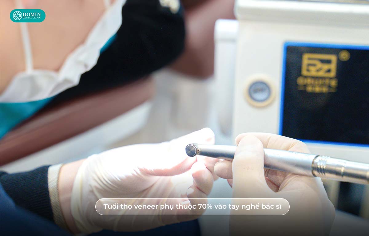 Tuổi thọ veneer phụ thuộc 70% vào tay nghề bác sĩ