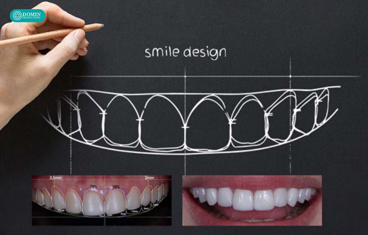 Nên chọn nha khoa trang bị đầy đủ thiết bị như máy scan, phần mềm thiết kế nụ cười