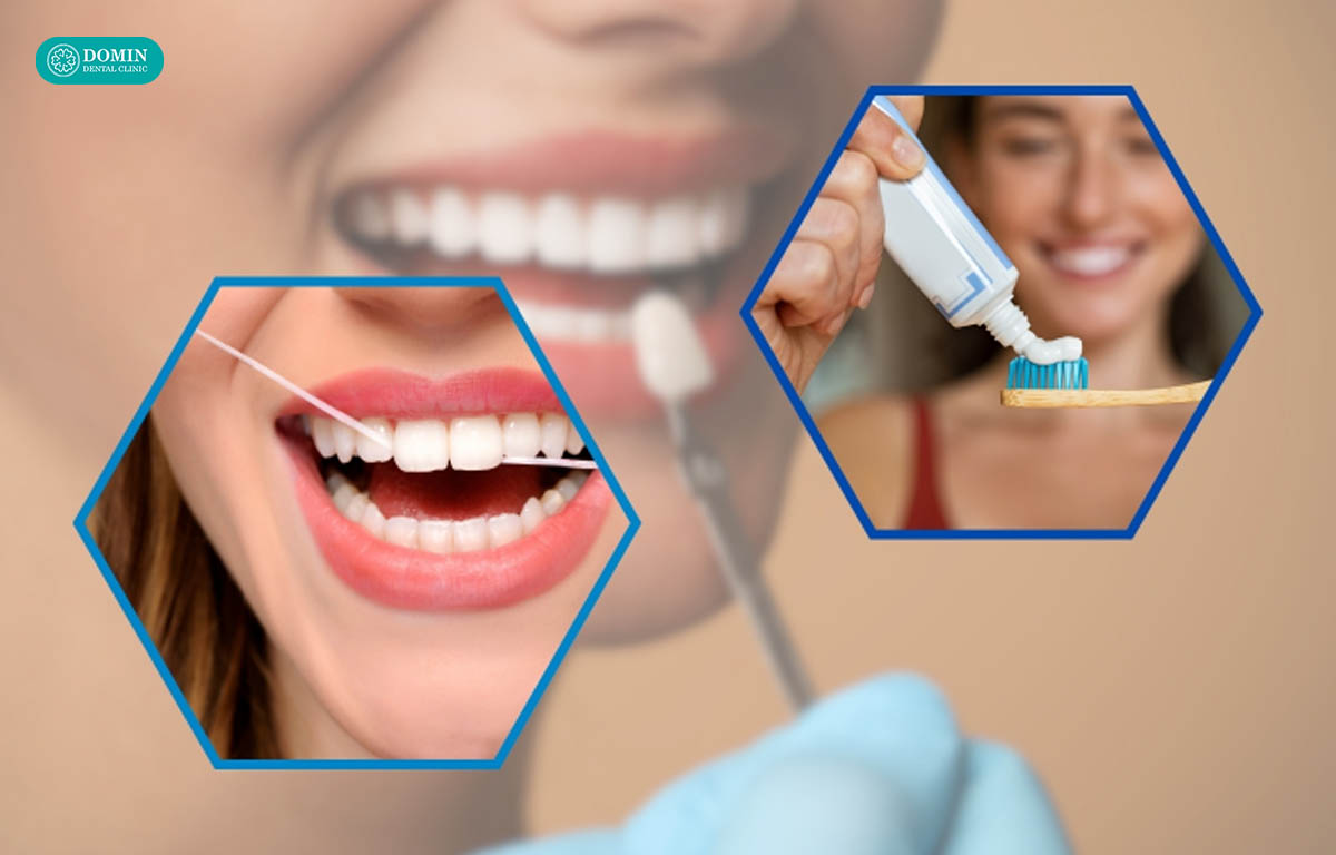 Làm sạch răng dán sứ là yếu tố quan trọng để duy trì tuổi thọ.