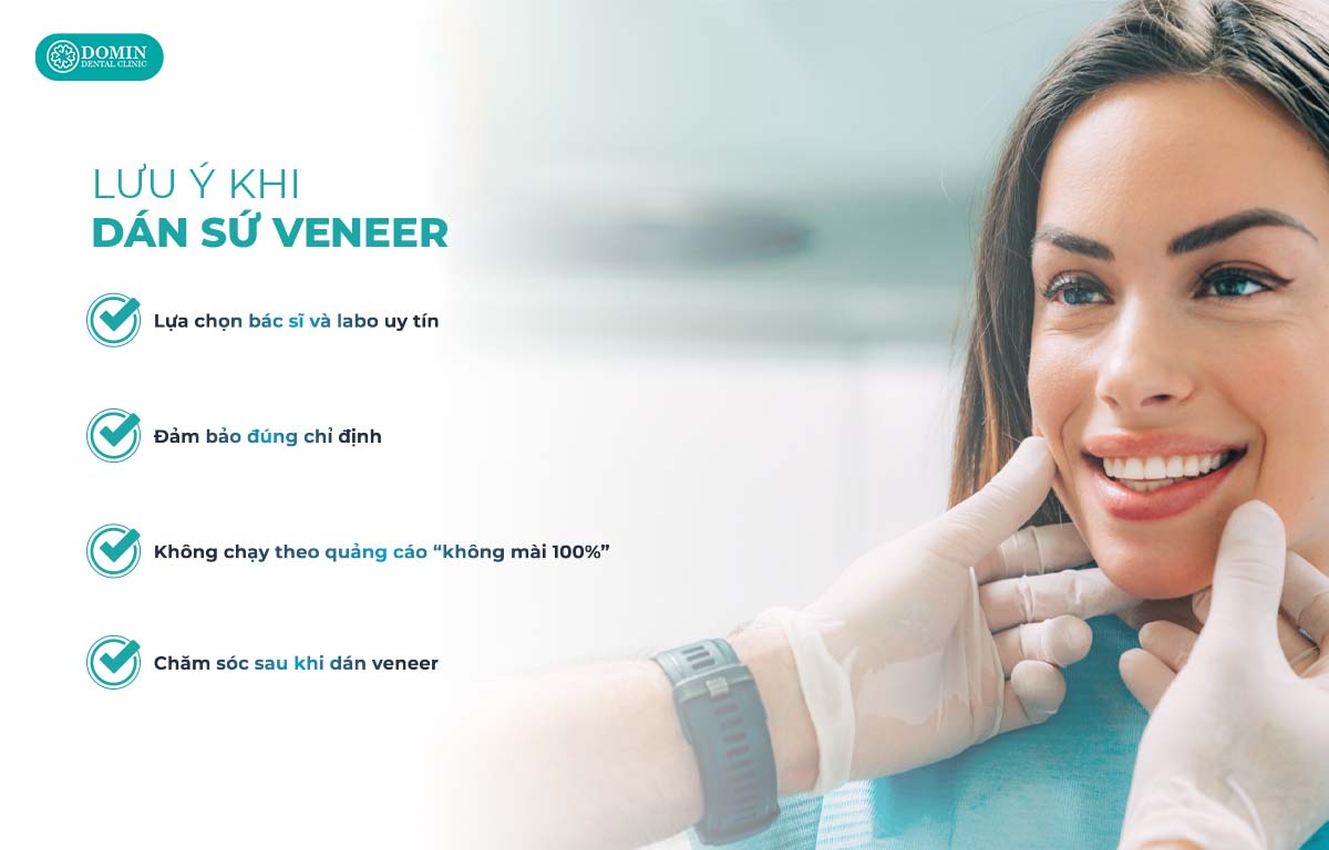 Dán sứ veneer siêu mỏng cần tuân thủ 4 lưu ý sau.