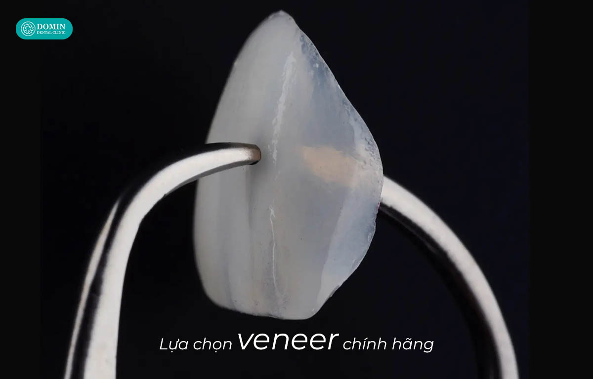 Lựa chọn vật liệu chính hãng để duy trì độ bền của veneer.