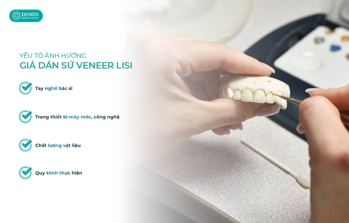 Có nhiều yếu tố ảnh hưởng giá dán sứ veneer Lisi