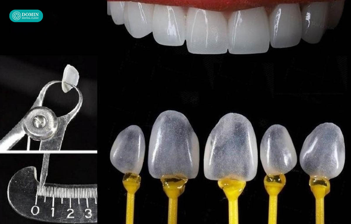 Khả năng phản xạ ánh sáng tốt giúp veneer Lisi Press trong, tự nhiên.