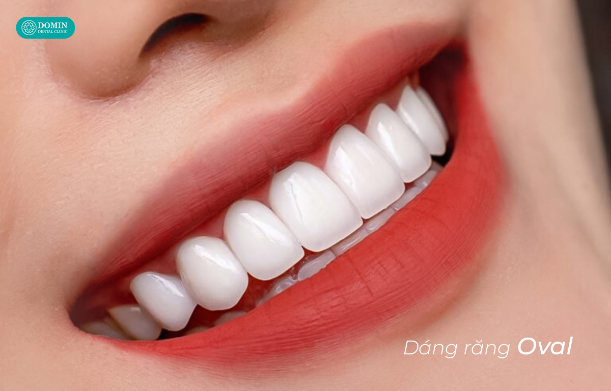 Dáng răng oval được đánh giá phù hợp với người có khuôn mặt tròn.