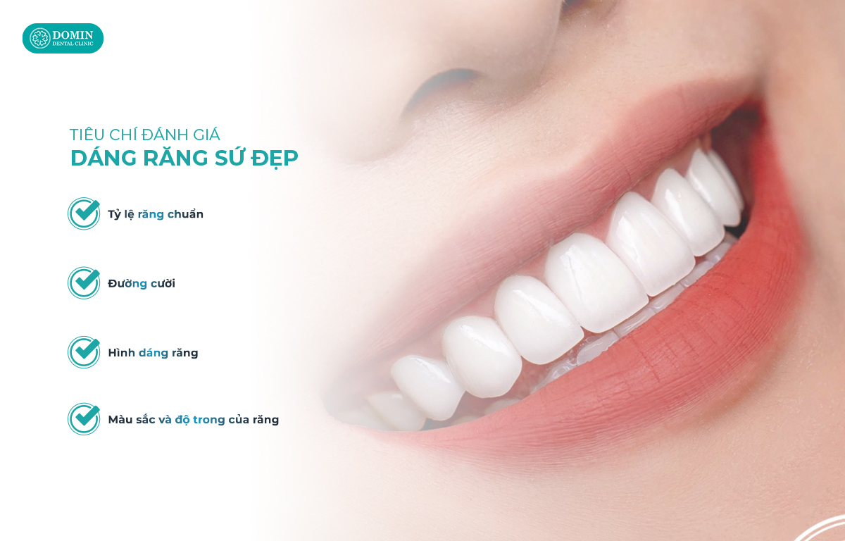 Có 4 tiêu chí để đánh giá một dáng răng sứ đẹp.