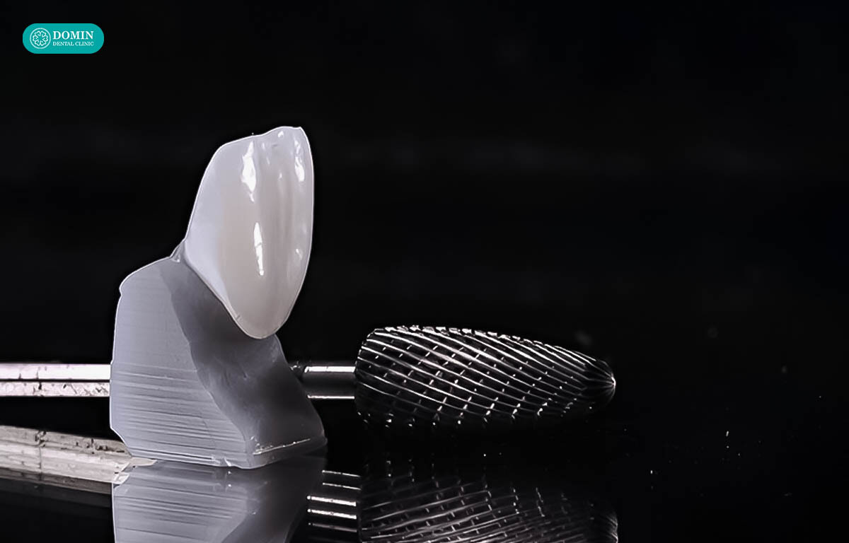 Răng sứ Lisi Press được làm từ sứ thuỷ tinh ép, đảm bảo mỏng, thẩm mỹ tối ưu.
