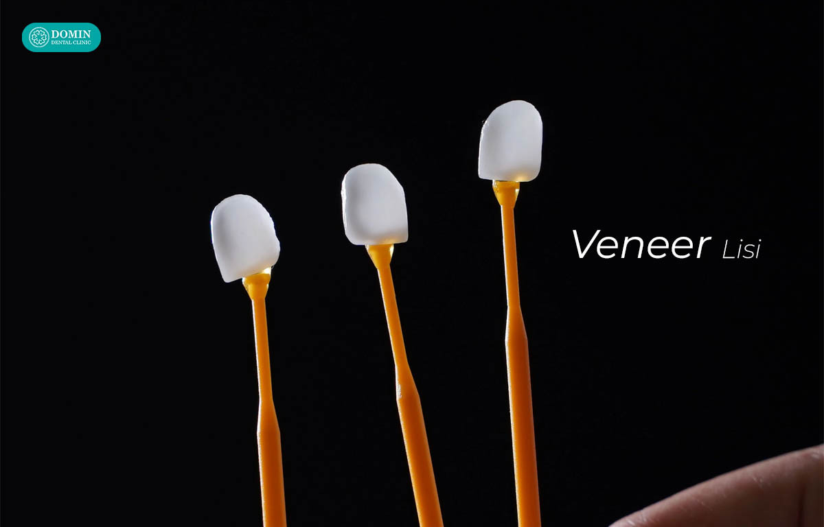 Trong như răng thật, màu sắc ổn định là ưu điểm của veneer Lisi