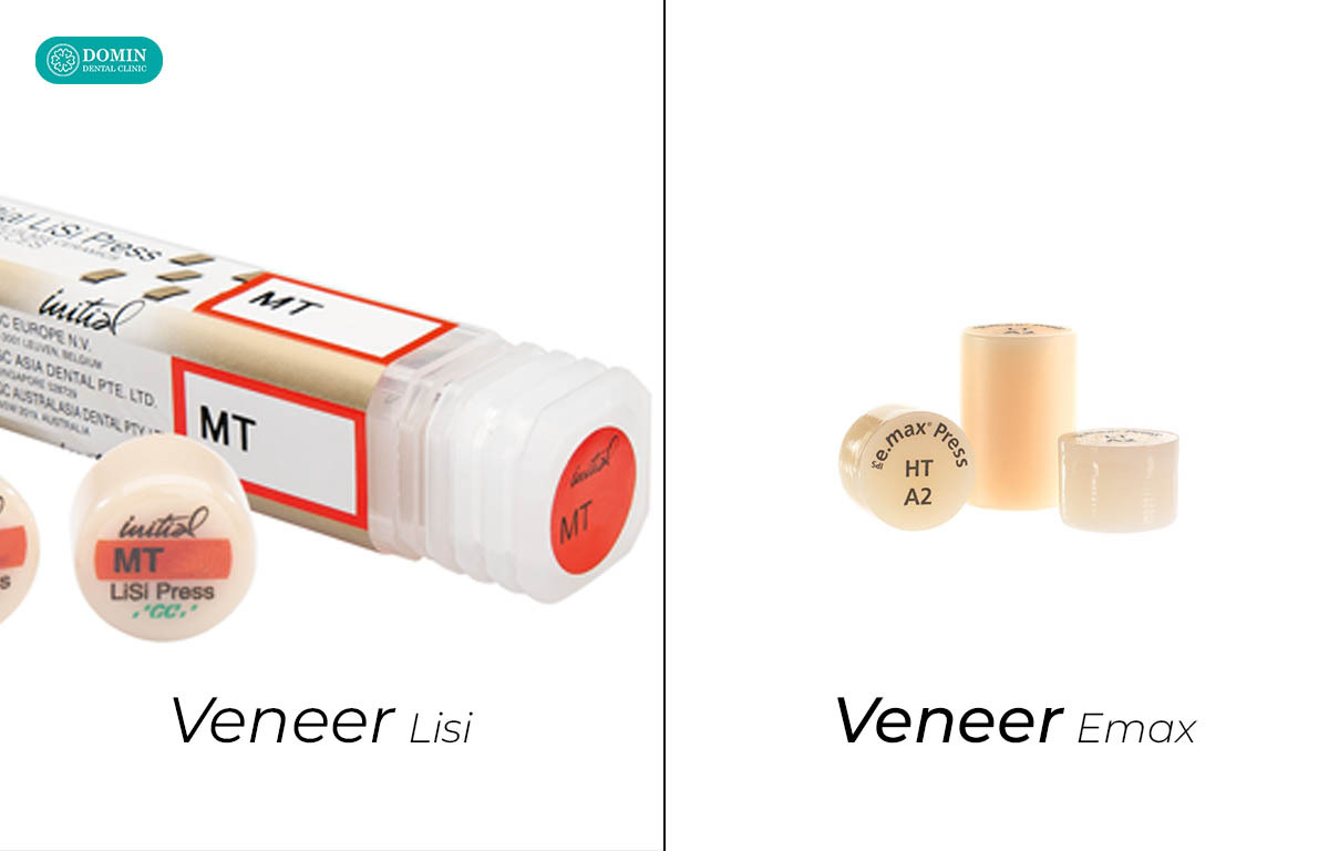 Chọn dán sứ veneer Lisi hay Emax phụ thuộc vào tình trạng và nhu cầu.