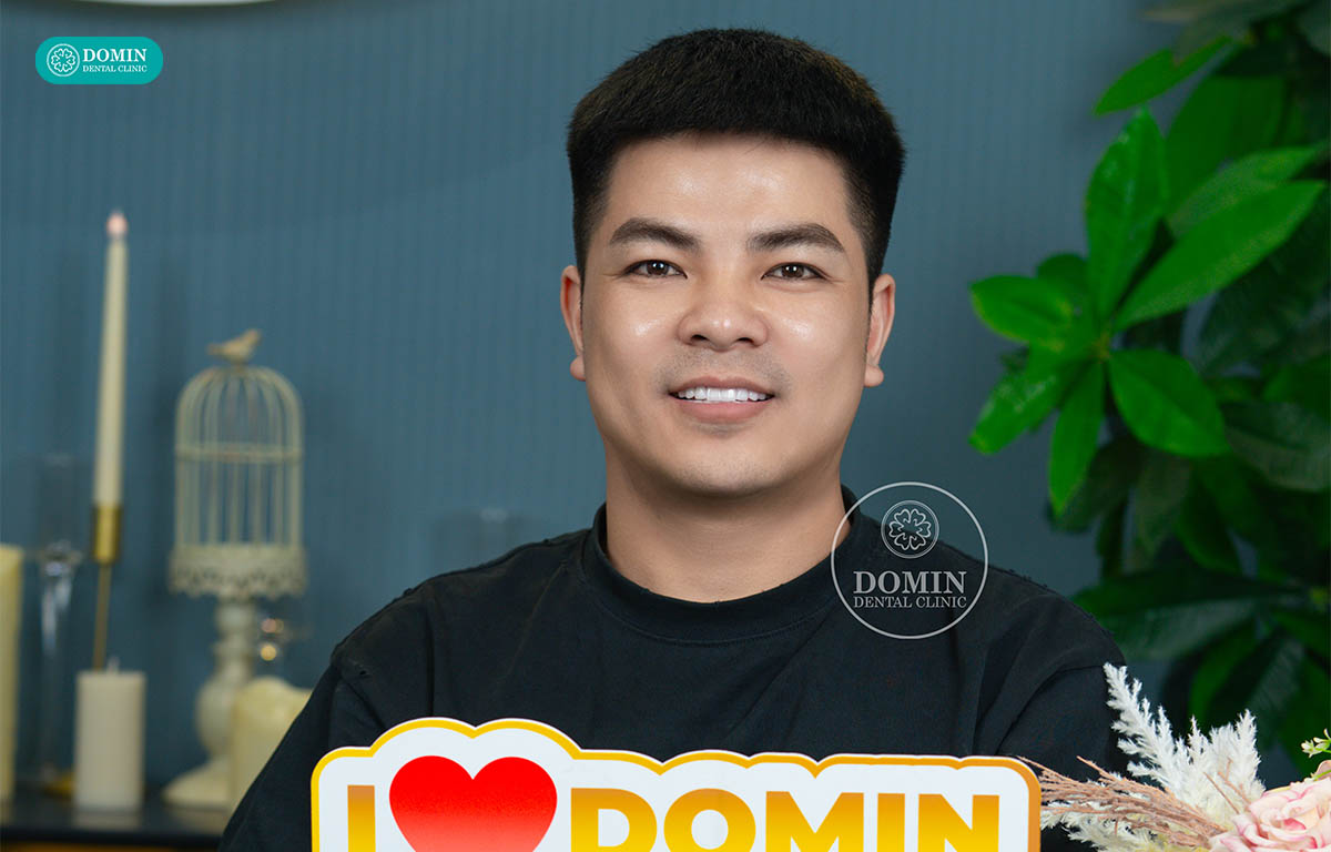 Khuôn mặt vuông
